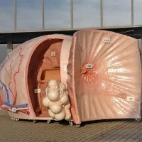 Del ozaveščanja je  potujoči model s prikazom predrakavih sprememb in faz raka na prostati.  