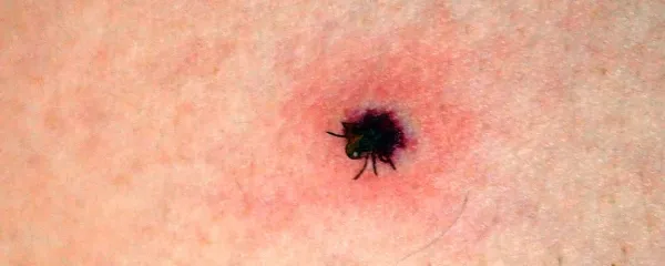 Klopi se radi prisesajo tudi v kožo psov in mačk.