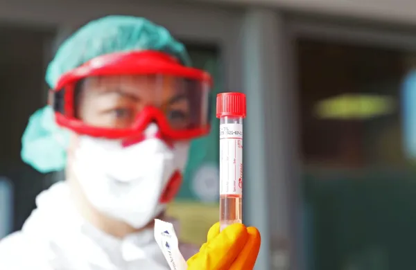 V Sežani po naključju odkrili še dve osebi, pozitivni na test za covid-19