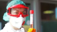 V Sežani po naključju odkrili še dve osebi, pozitivni na test za covid-19