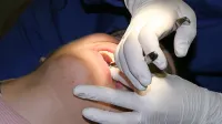 Posebne covid urgentne zobozdravstvene ambulante v Kopru ni, 
okužene v primeru nuje sprejemajo na južnem Primorskem 
njihove redne  zobozdravstvene ambulante, a po zaključku delovnega časa. 