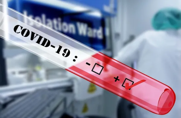 Zdravništvo meni, da bodo prave analize o spopadanju z epidemijo, primernosti ukrepov  in smrtih možni  šele konec prihodnjega leta.  