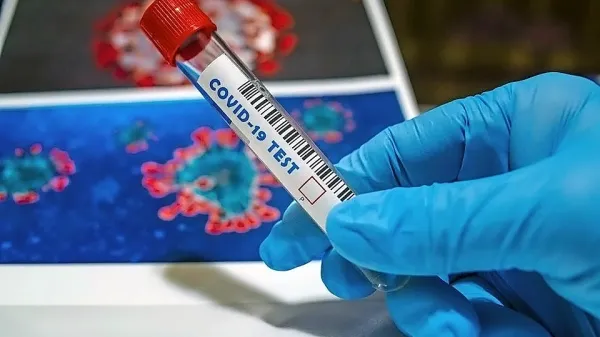V soboto potrdili 614 okužb z novim koronavirusom, v Ajdovščini 14