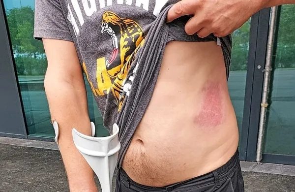 Tako jo je skupil eden izmed izolskih navijačev, ki ga je član 
ljubljanske navijaške skupine žgal z gorečo baklo.