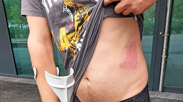 Tako jo je skupil eden izmed izolskih navijačev, ki ga je član 
ljubljanske navijaške skupine žgal z gorečo baklo.