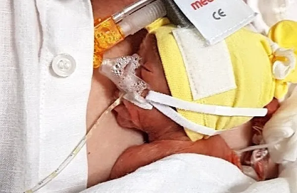 Medicina lahko danes da upanje na zdravega otroka tudi staršem, 
ki se jim rodi nedonošenček štiri mesece prezgodaj. 