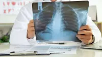 So plače radiologov v javnih bolnišnicah res tako nizke, da ti odhajajo k zasebnikom? Resnica je ravno 
nasprotna.

