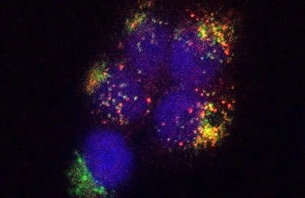 Fotografija ne prikazuje vesoljske scene, pač pa kako se virusu 
podoben delec (psevdovirion) s časom prebije v celico. Posneta je 
bila s konfokalno mikroskopijo.