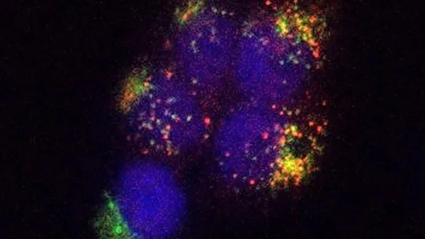 Fotografija ne prikazuje vesoljske scene, pač pa kako se virusu 
podoben delec (psevdovirion) s časom prebije v celico. Posneta je 
bila s konfokalno mikroskopijo.