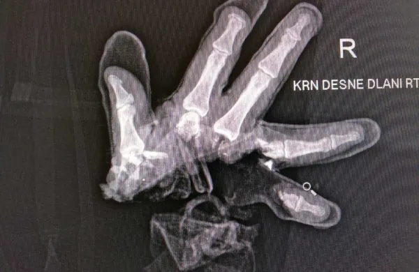 Za varne praznike brez motečega pokanja