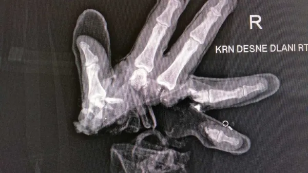 Za varne praznike brez motečega pokanja