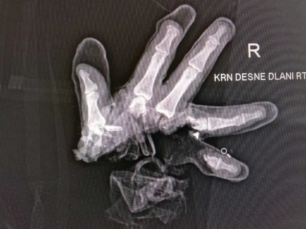 Za varne praznike brez motečega pokanja