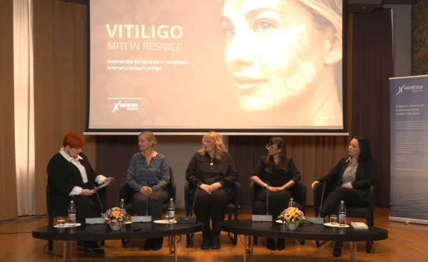 Ljubljana, Hotel Slon.Novinarska konferenca o bolezni vitiligo v organizaciji druzbe Aetas.Foto: STA