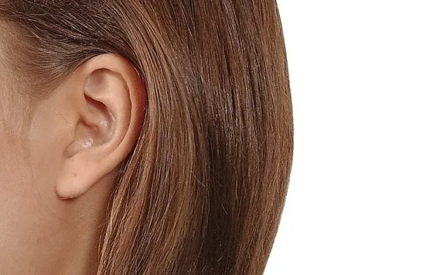 Vlada 3. februar razglasila za slovenski dan tinitusa