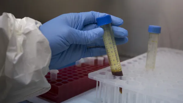 Pri Svetovni zdravstveni organizaciji (WHO) so zaskrbljeni zaradi obsega in hitrosti &scaron;irjenja epidemije ebole v DR Kongo in Ugandi.